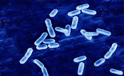 La bacteria que causa la listeriosis, en una imagen de microscopio.