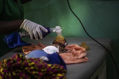 Un recién nacido es reanimado en la sala de urgencias de pediatría del Hospital Nacional Simão Mendes.