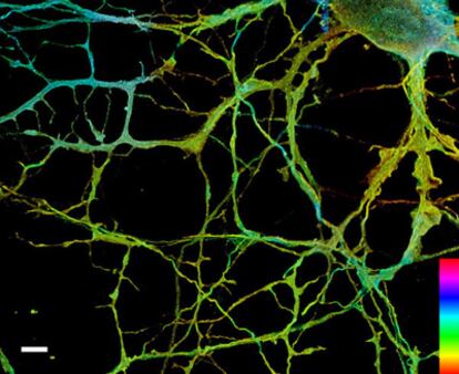 Imagen tridimensional de una neurona tomada con el sistema de tecnología STORM de Harvard.