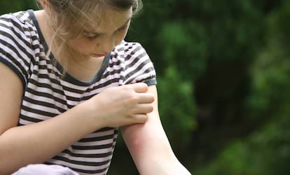 Una niña con una picadura.