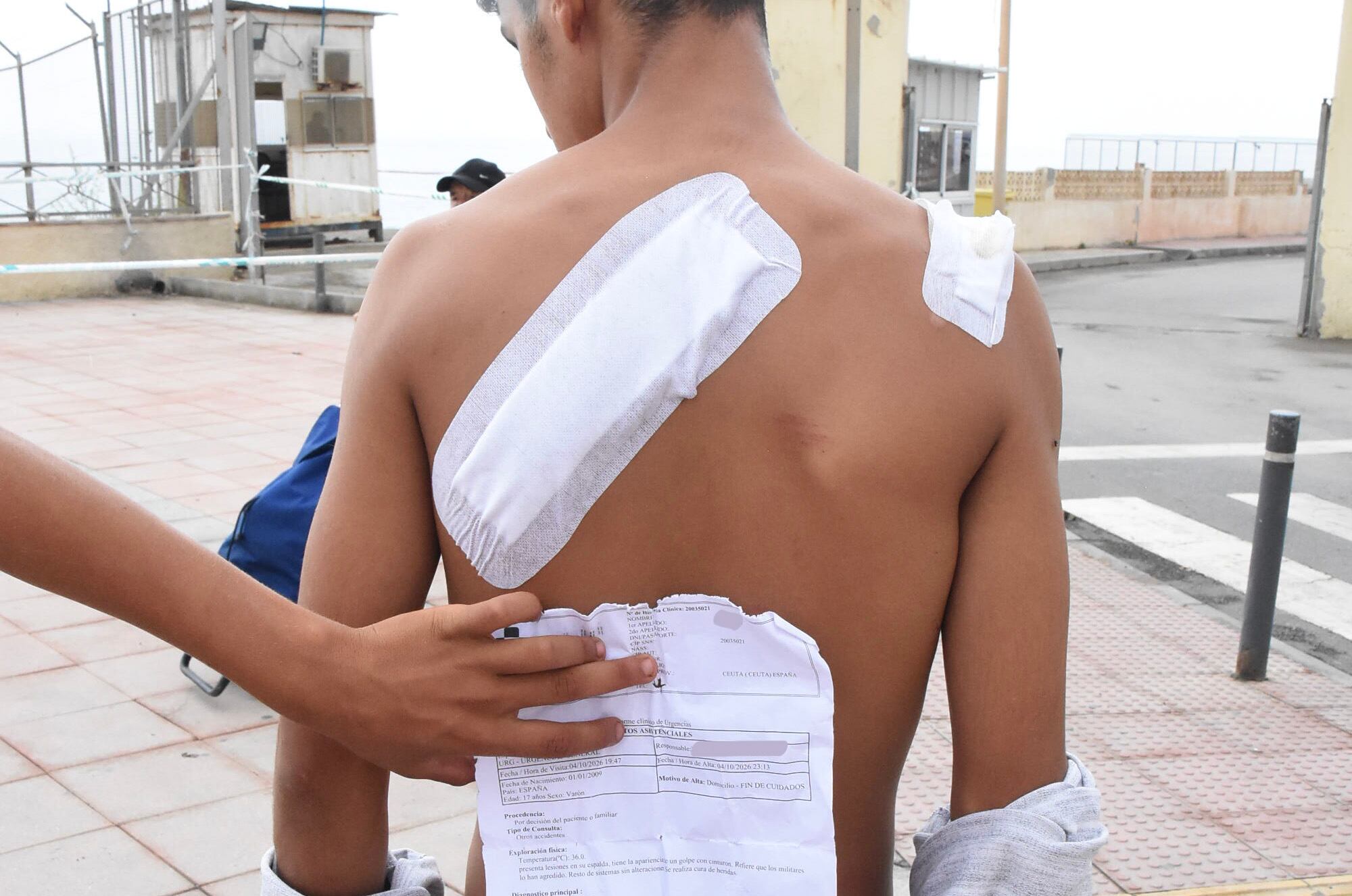 Un joven inmigrante muestra en Ceuta la cura de las lesiones supuestamente causadas por militares y el parte médico del pasado 4 de octubre.