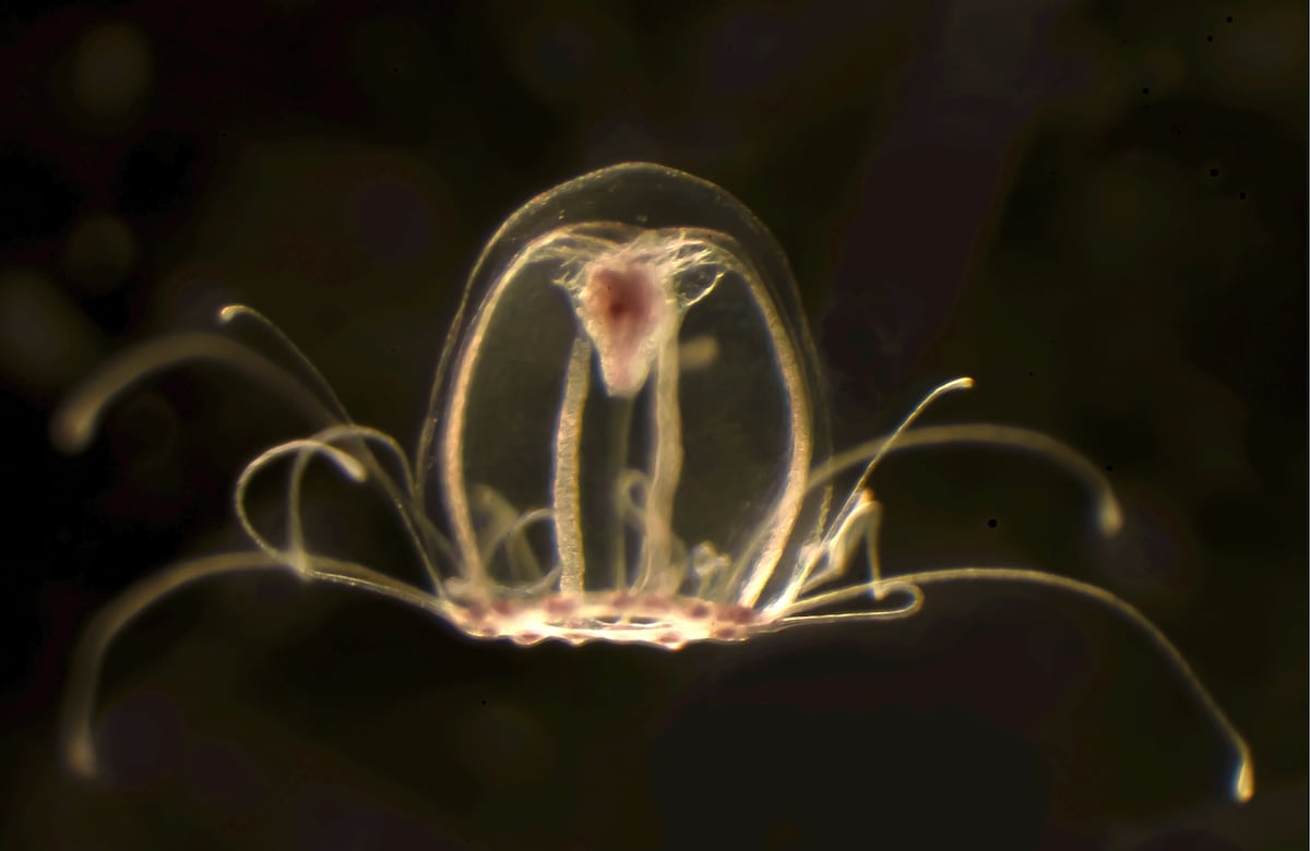 'a jellyfish under a microscope'