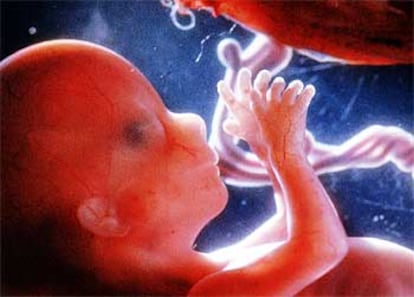 Imagen de un feto en el seno materno en la última fase de la gestación.