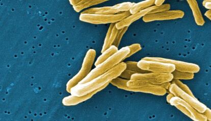 Bacteria de la tuberculosis vista a través de un microscopio.