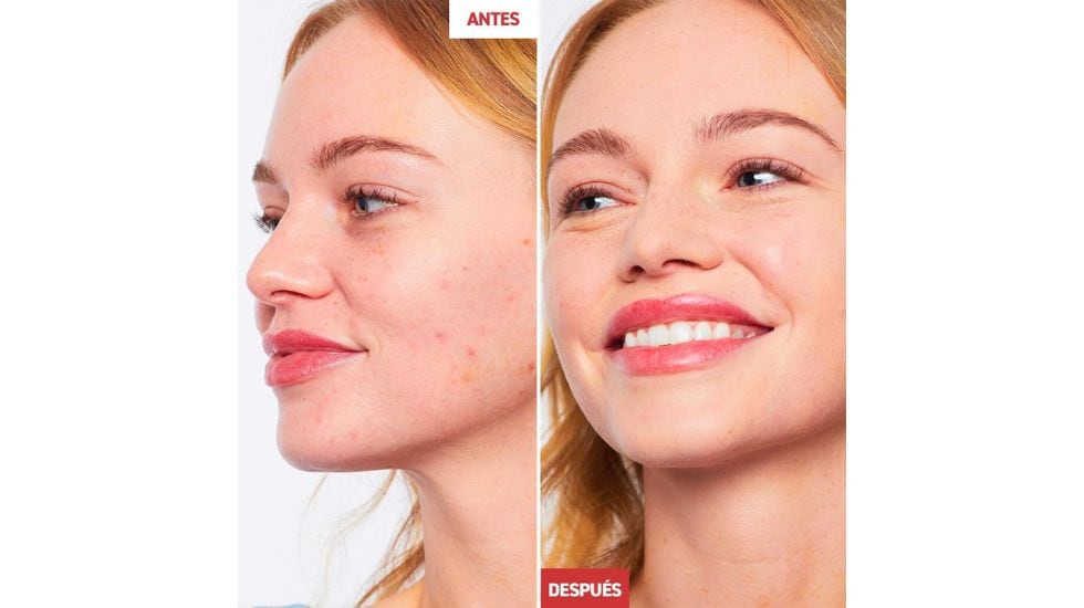 Diferencias antes y después de aplicar la CC Crème de Erborian.