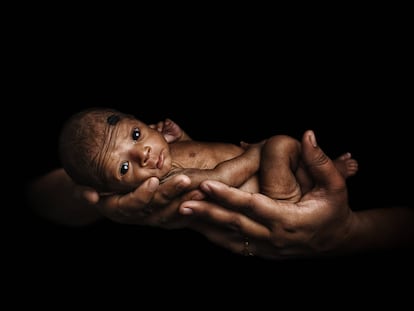 Los bebés en países pobres consumen más leche materna que en los ricos