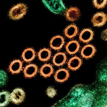 Una sección transversal de partículas de virus de influenza (cepa porcina) encontradas cerca de la superficie de una célula infectada. La primera aparición registrada de lo que se conoce como gripe A fue en 1918 y mató a más de 50 millones de personas. Ha dejado huella ya que vuelve cada año, pero con menor impacto, como una gripe estacional. En 1957, en Asia, una variante de este virus (H2N2) causó la gripe asiática que acabó con la vida de casi un millón de personas. En 2009, volvió un subtipo y dio lugar a la denominada gripe porcina.