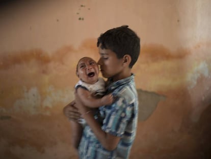 Elison, 10, segura o irmão José, 2 meses, que nasceu com microcefalia.