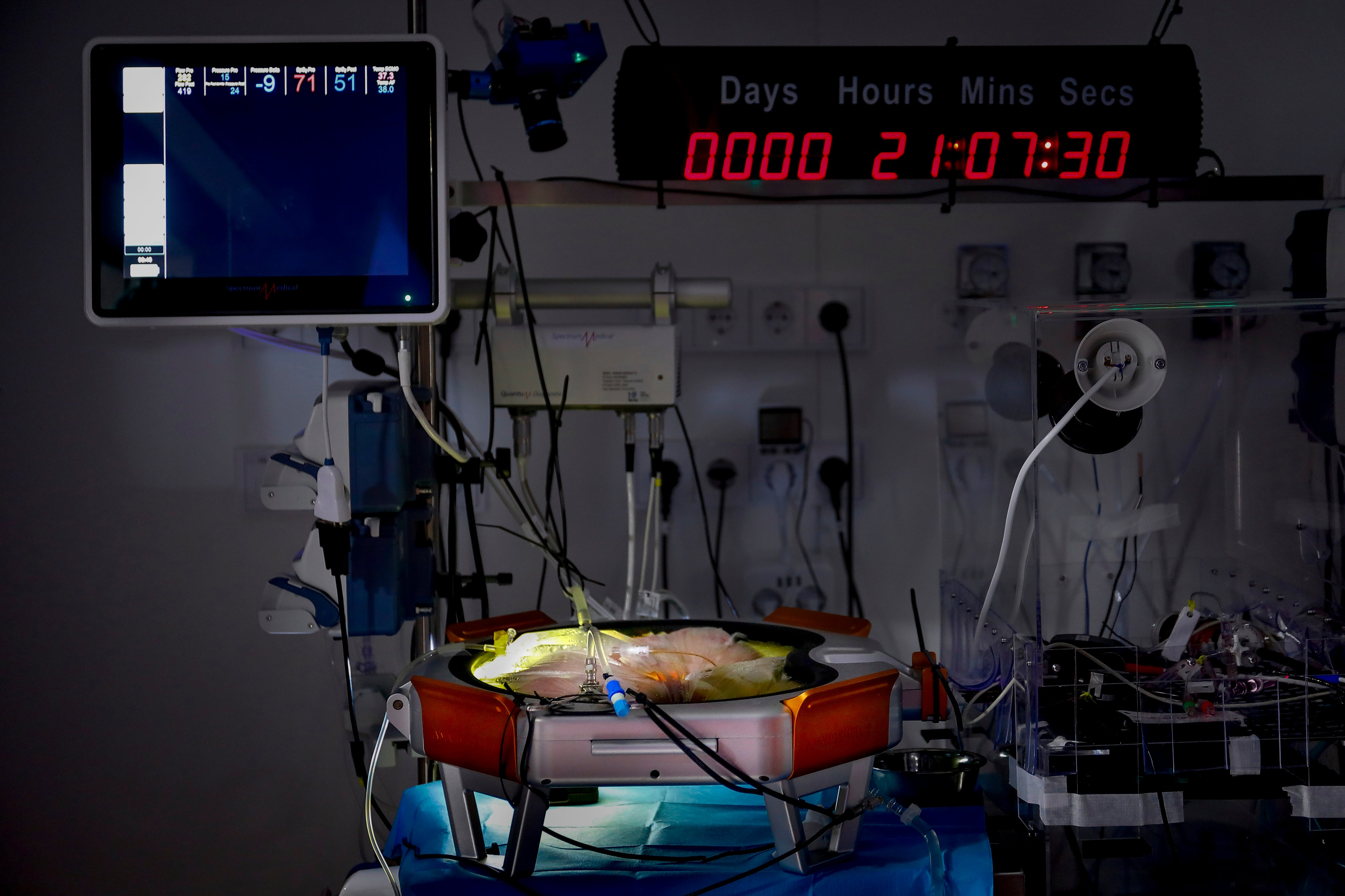 Un prototipo de placenta artificial para prematuros extremos logra mantener con vida un feto de oveja durante 21 días