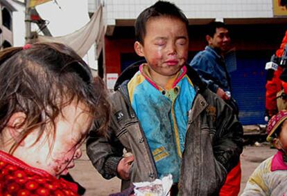 Dos niños con quemaduras en el rostro son tratados en un hospital de Kaixian.