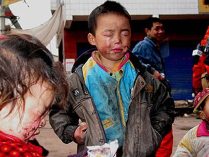 Dos niños con quemaduras en el rostro son tratados en un hospital de Kaixian.