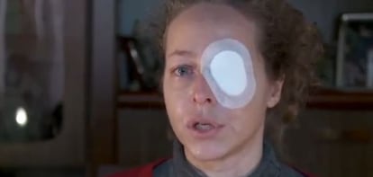 Esther Quintana, who lost an eye during the November 14 strike.