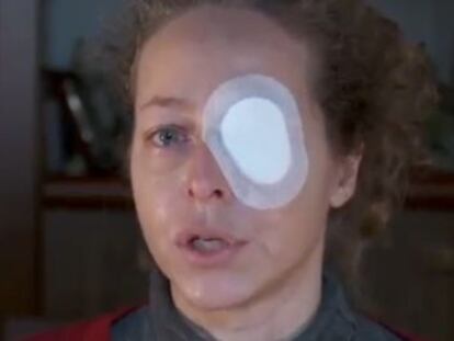 Esther Quintana, who lost an eye during the November 14 strike.