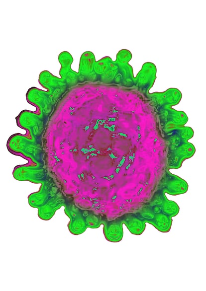 Una imagen microscópica del coronavirus.