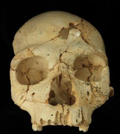 Cráneo 17, de hace 436.000 años, hallado en la Sima de los huesos (Atapuerca, Burgos), con dos perforaciones en la frente posiblemente debidas a una agresión mortal intencionada.