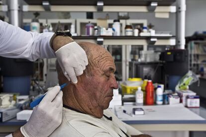 Pedro Torres, responsable del laboratorio de Fontilles, practica un raspado rutinario a Abilio con el fin de comprobar si la lepra ha sido totalmente erradicada de su cuerpo. Abilio, de 70 años de edad, es el último paciente que ha ingresado en el centro. Lo hizo hace dos años. 