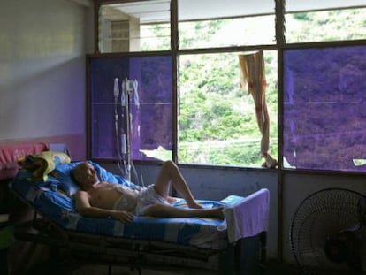 Un paciente en el hospital Central de Maracay, Venezuela.