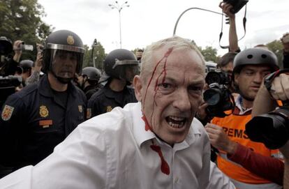 Uno de los heridos en la carga policial cuando varios jóvenes de la protesta del 25S intentaron traspasar la valla que protege el acceso al Congreso.