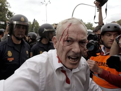 Uno de los heridos en la carga policial cuando varios jóvenes de la protesta del 25S intentaron traspasar la valla que protege el acceso al Congreso.