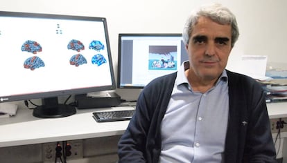 El doctor Pujol, del hospital del Mar, que ha liderado la investigación sobre el cerebro de los psicópatas