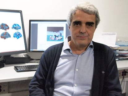 El doctor Pujol, del hospital del Mar, que ha liderado la investigación sobre el cerebro de los psicópatas