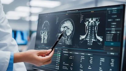 La Inteligencia Artificial está transformando el diagnóstico del cáncer.