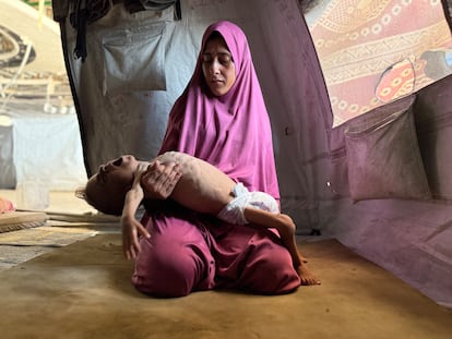 El pequeño gazatí Mohamed Motawaq, de tan solo 18 meses, pasa los días en brazos de su madre, Hidaya al Mutauaq, en un campamento en Gaza.