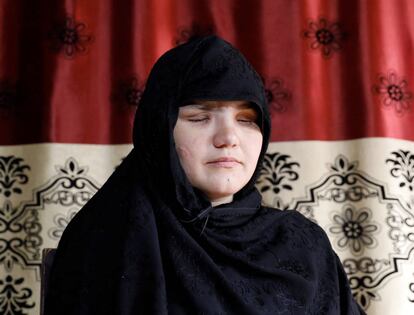 Khatera, policía cegada por un grupo de hombres armados en la provincia de Ghazni (Afganistán).