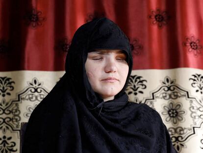 Khatera, policía cegada por un grupo de hombres armados en la provincia de Ghazni (Afganistán).