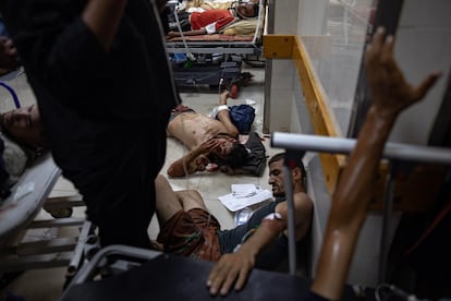 Several wounded people are being treated at Nasser Hospital following an Israeli attack in Al Mawasi on Saturday. 