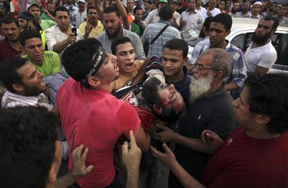 El Cairo, Egipto, 27 de julio de 2013. Decenas de islamistas murieron en una de las jornadas más sangrientas de la turbulenta transición egipcia. La batalla campal entre los islamistas, que volvían a movilizarse para forzar al ejército a restituir a Morsi, y las fuerzas de seguridad, se prolongó durante cinco horas. El crescendo de sangre y represión arruinaba una eventual solución dialogada a la crisis desatada tras el golpe. En la imagen, varios partidarios del depuesto presidente Morsi trasladan a un herido al hospital.