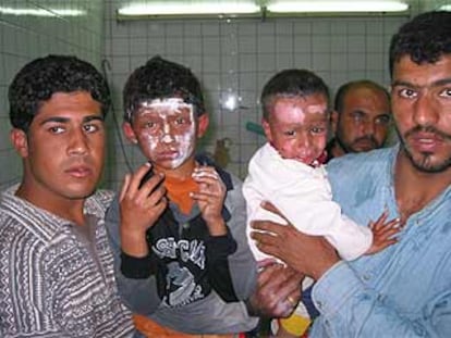Una familia muestra a dos niños con la cara quemada por la explosión de una bomba en Bagdad.