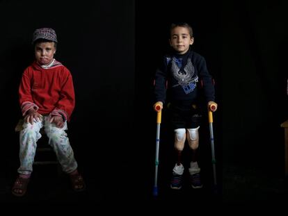 Fátima, izquierda, fue víctima de un bombardeo en un campamento de refugiados. Lamut, centro, sufrió una explosión en Idlib. Reza, derecha, fue herida en Alepo en 2014.