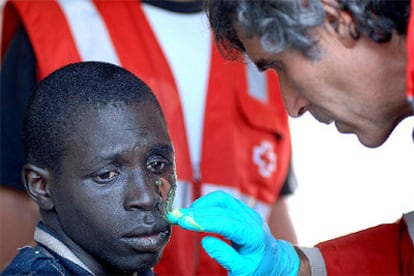 Un inmigrante con quemaduras en su rostro es atendido por un médico de Cruz Roja a su llegada a Fuerteventura.
