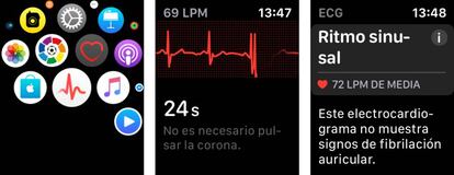 Electrocardiograma en Apple Watch Series 4