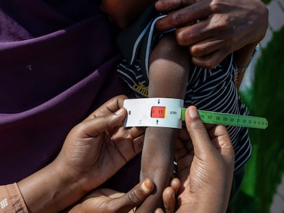 Medición del brazo de un niño en una campaña contra la malnutrición en Mogadiscio (Somalia), en junio de 2022.