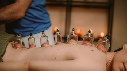 Una mujer recibe una pseudoterapia con chupones en la espalda.