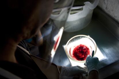 Un doctor revisa los restos de un procedimiento de aborto, en una clínica en Ciudad de México.