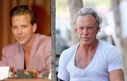 Mickey Rourke es el claro exponente de un cirugía estética mal hecha.