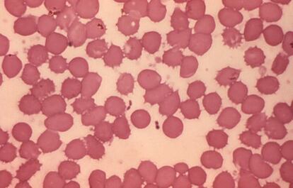 Muestra de sangre con bacterias 'Yersinia pestis', que causan la peste.
