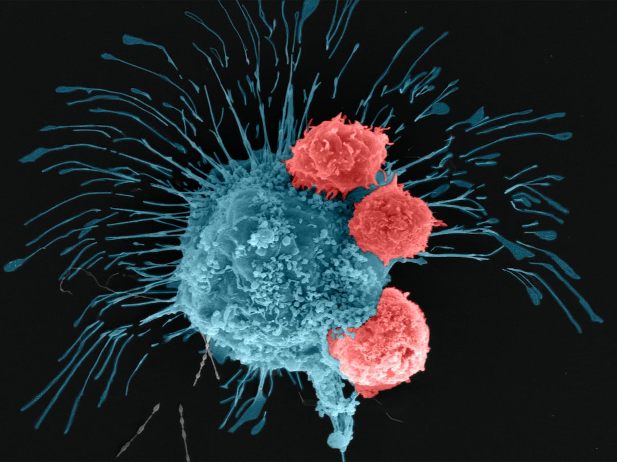 Largest Cancer Atlas Reveals New Treatments for Incurable Tumors | Health and Wellness