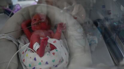 Valeria, en la UCI neonatal del Gregorio Marañón, el 30 de agosto de 2021.