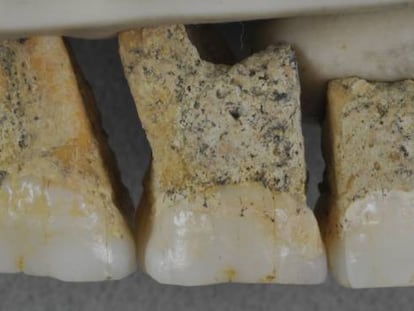 Dientes superiores del CCH6 individual, el espécimen tipo de la nueva especie Homo luzonensis. 