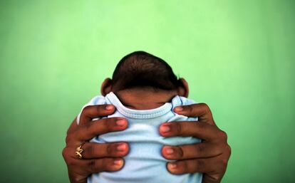 Una madre sostiene a su hijo de 4 meses de edad nacido con microcefalia por el virus del Zica, frente a su casa en Olinda (Brasil), el 11 de febrero de 2016.