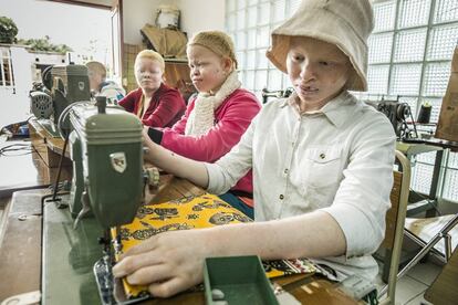 Las mujeres albinas pueden dignificar sus vidas marcadas por la múltiple discriminación en un continente donde los albinos no tienen derecho ni a una existencia mísera.