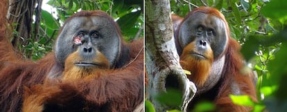 Este orangután de Sumatra pudo salir herido de una pelea con otro macho. En la composición, el resultado del enfrentamiento (a la izquierda) y su curación, con una pequeña cicatriz, semanas después.