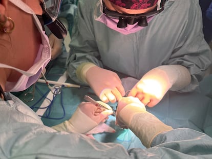 El equipo médico del 12 de Octubre, en plena operación al bebé de 21 días.