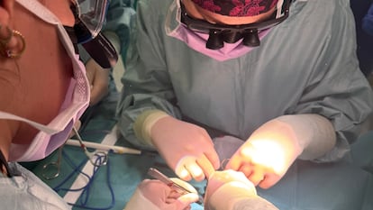 El equipo médico del 12 de Octubre, en plena operación al bebé de 21 días.