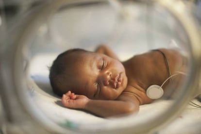 Un bebé prematuro duerme en la incubadora.