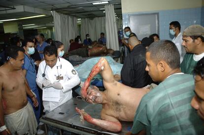Los heridos son atendidos en el hospital Escuela de la capital Tegucigalpa.